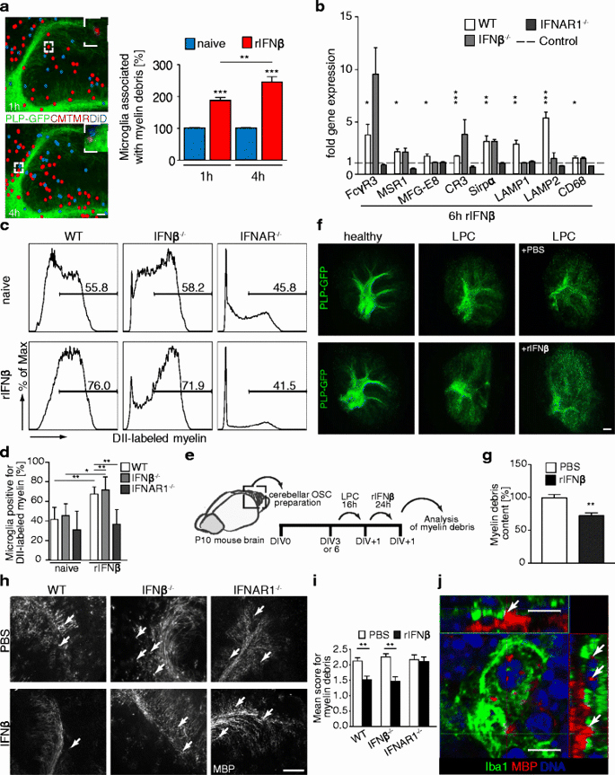 Dot to Dot Adults ifnÎ² Secreted by Microglia Mediates Clearance Of Myelin